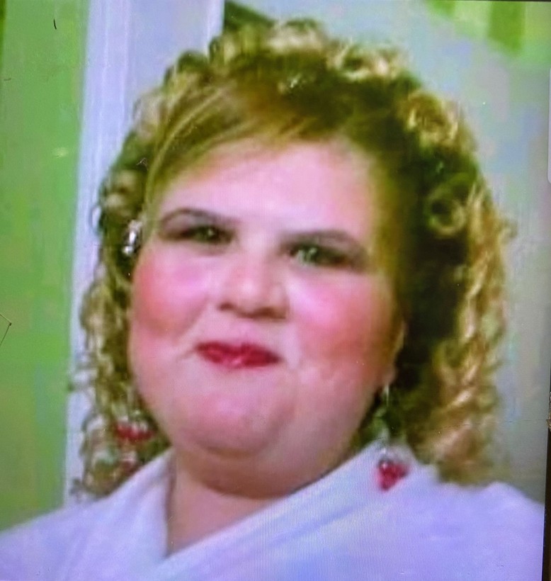 Zayıflamak için aldığı ilaç obez yaptı! Kilosunun 4 katına çıktı, eşi terk etti: "Ben yandım kimse yanmasın" - Resim: 3