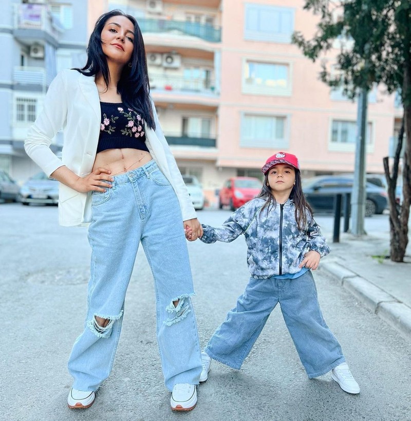 Kemik kanseri, meme kanseri, lenfoma... Hepsini yendi kolon kanseriyle mücadeleyi kaybetti! Fenomen Ayşenur Parlak hayatını kaybetti - Resim: 2