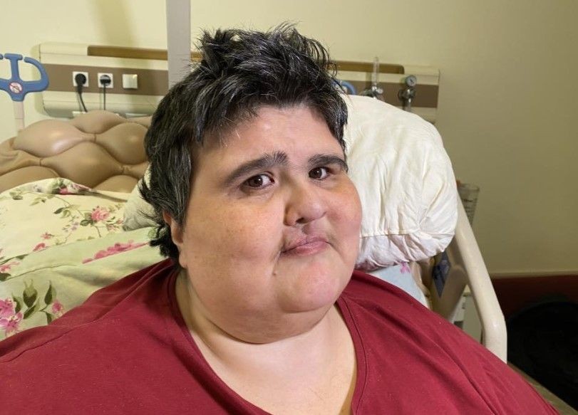Zayıflamak için aldığı ilaç obez yaptı! Kilosunun 4 katına çıktı, eşi terk etti: "Ben yandım kimse yanmasın" - Resim: 5