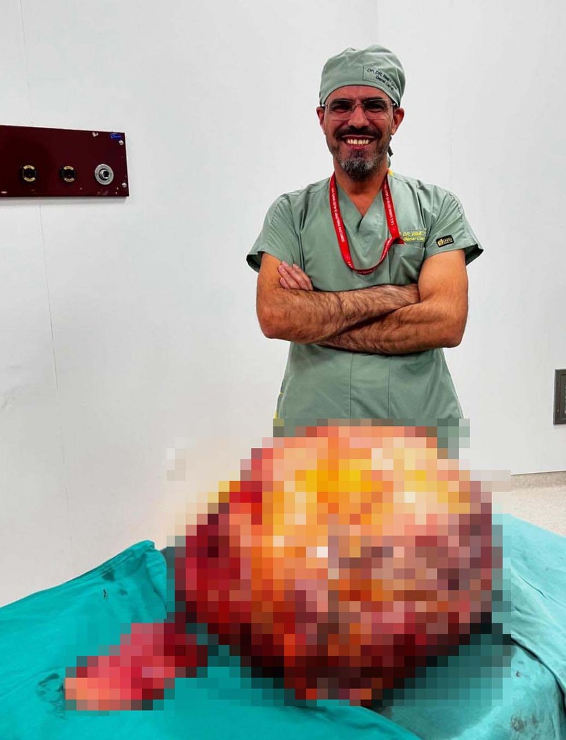 'Karın ağrısı' şikayetiyle gittiği hastanede karnından 26 kiloluk tümör çıktı - Resim : 1