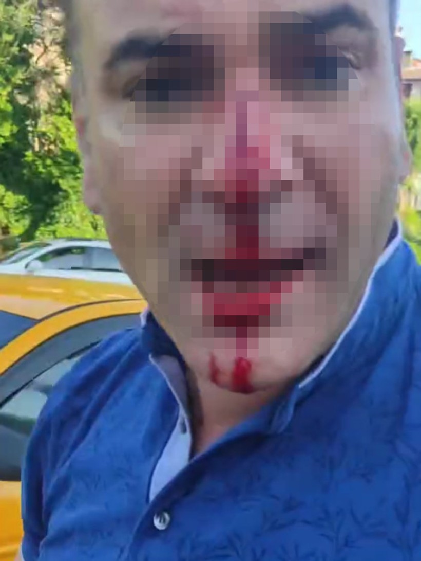 İstanbul'dan sonra Ankara'da: Eşinin ve çocuklarının yanında dövüp hastanelik ettiler - Resim : 1