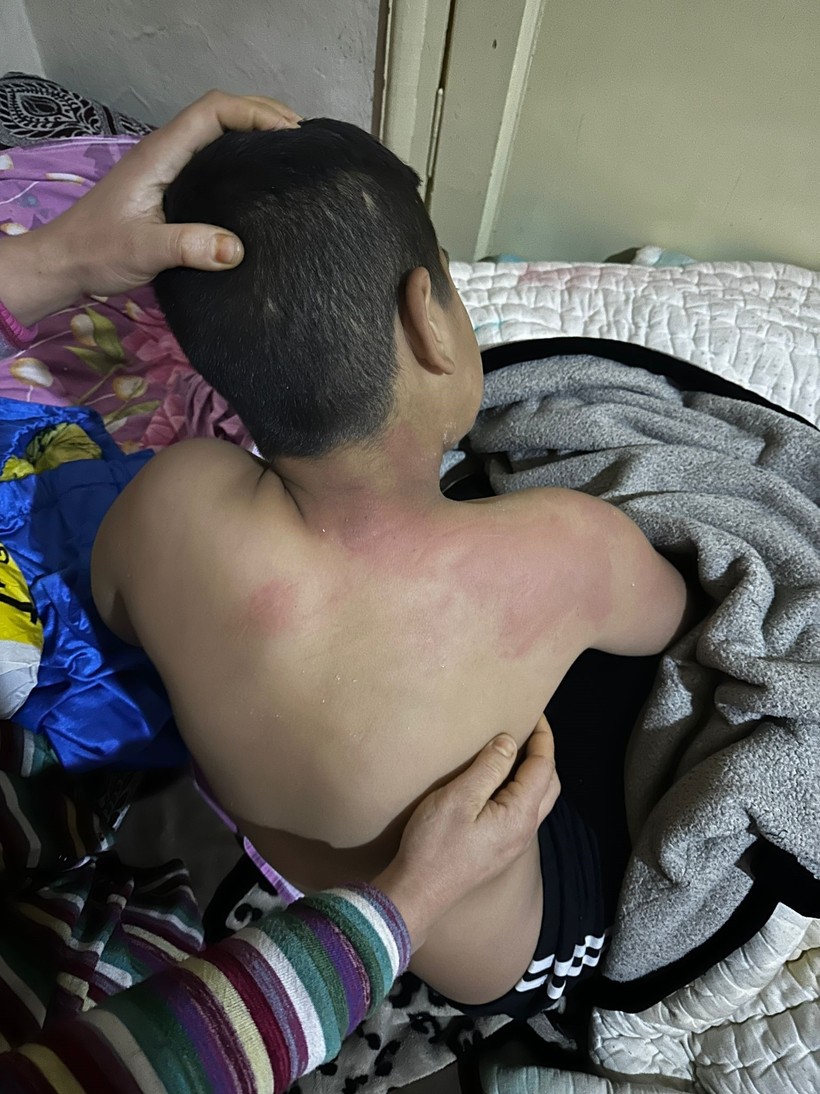 Seçim bürosuna gelen çocuğu kaynar suyla yakan şahıs tutuklandı - Resim : 2