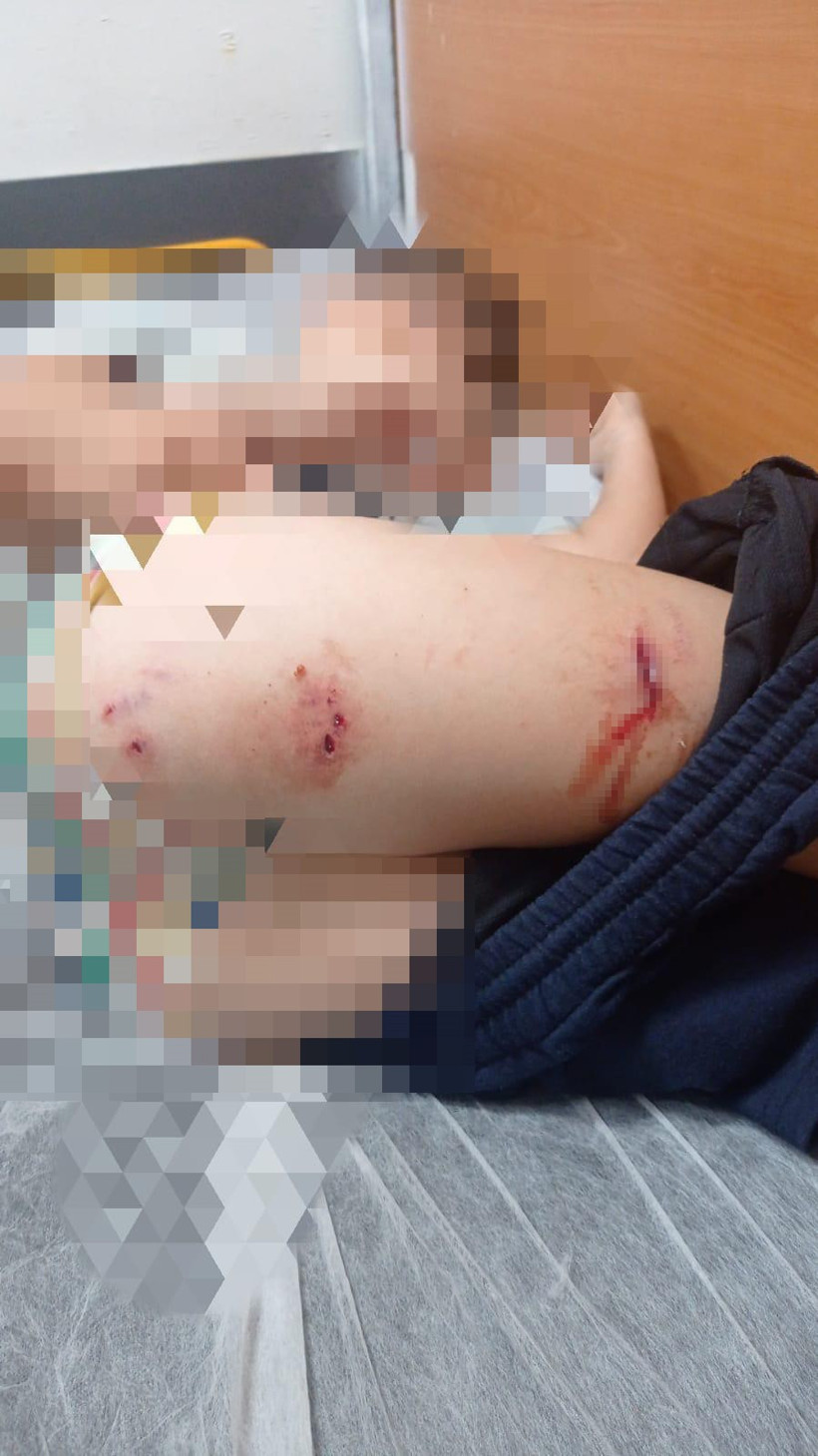 Sokak köpekleri faciaya neden oluyordu: Komşular yetişmeseydi parçalayacaklardı - Resim : 1