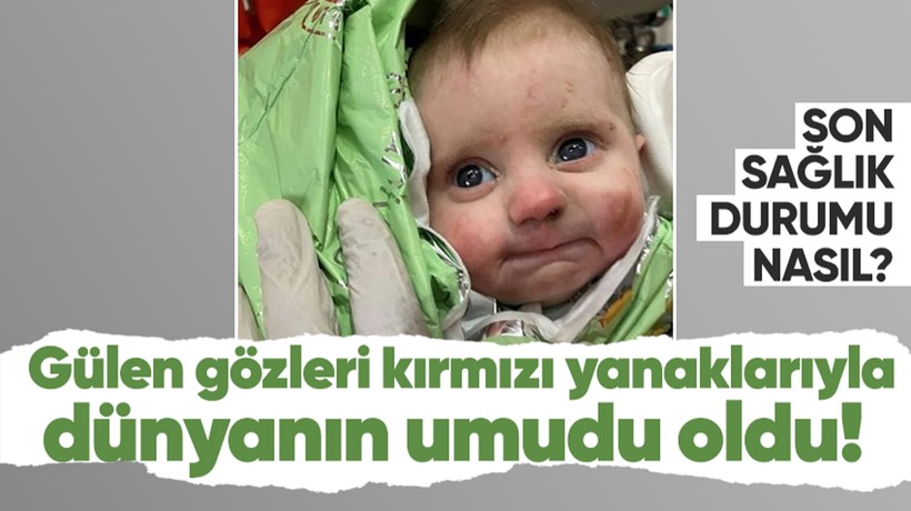 Gülen gözleri kırmızı yanaklarıyla dünyanın umudu oldu! Mucize bebek mucize kurtuluşuyla şoke etti! Son sağlık durumu ne?