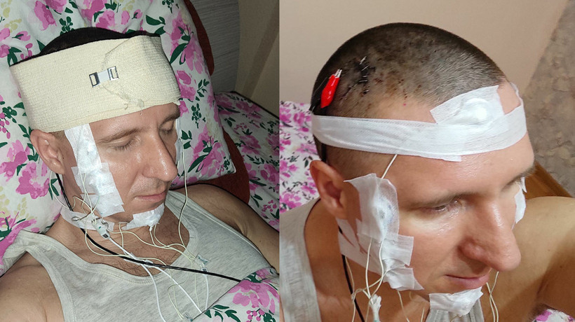Rus adam kafatasını deldi! Rüyalarını kontrol etmek istiyormuş