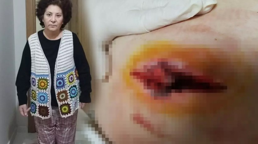 Dört hastasının ölümünden sorumlu olan doktor, kadının hayatını kararttı! 20 günde tam 420 dikiş atıldı..."Hayatımı elimden aldı"