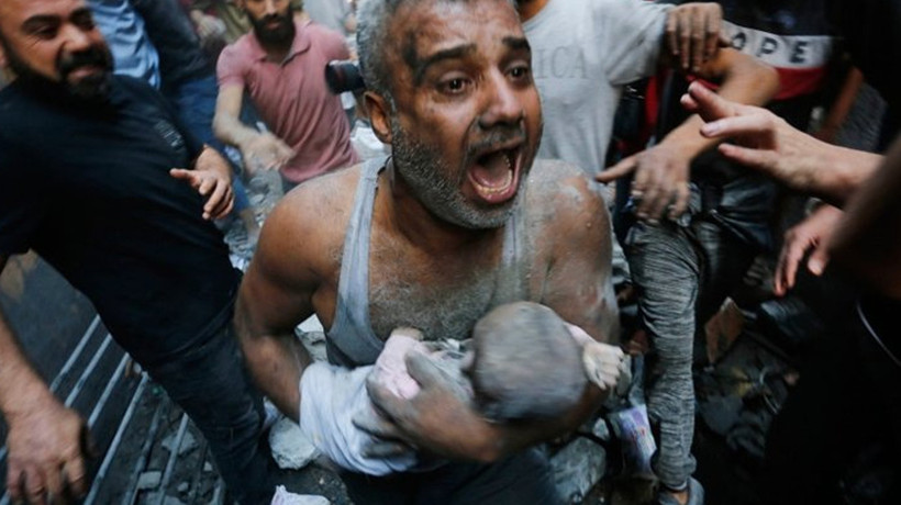 Batı medyasının kirli algı operasyonu! İsrail'in değil Filistin'in yaralı çocukları