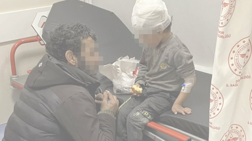 Sokak köpeği vahşeti devam ediyor! Diyarbakı'da 5 yaşındaki çocuk kabusu yaşadı