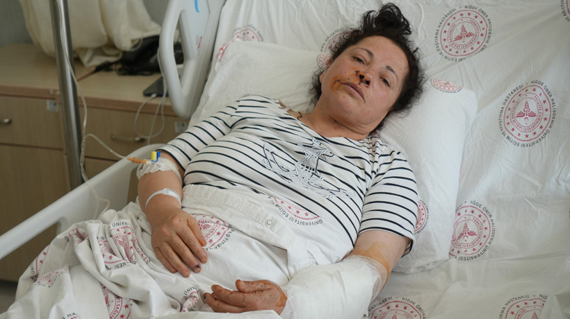 Niğde'de köpeklerin saldırısına uğrayan kadın dakikalarca kurtulma mücadelesi verdi