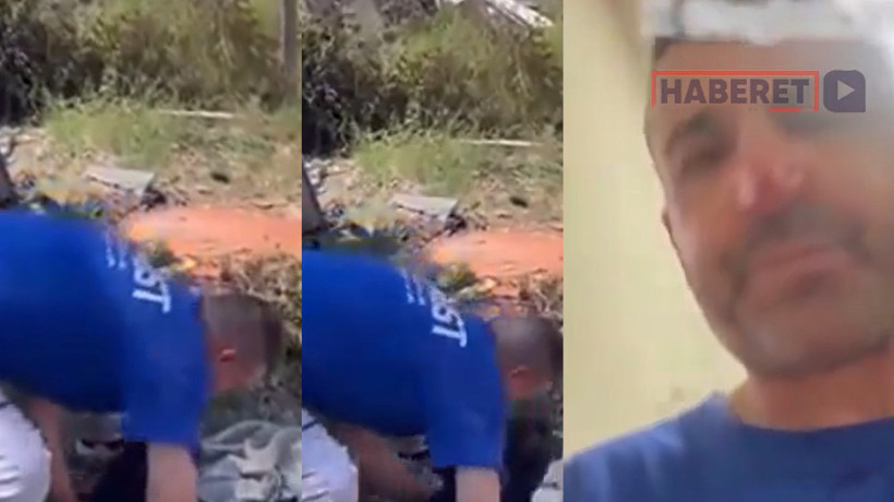 Yaralı köpeği beslerken saldırısına uğradı! Doktorun sözlerine rağmen tek derdi bakın ne oldu