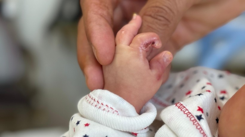 2 aylık Ömer bebeğin parmakları tedavi gördüğü hastane sakat kaldı