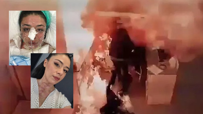 Hastanede alev alev yanan Gizem Hemşire dehşet gününü anlattı: Yakayım mı sizi