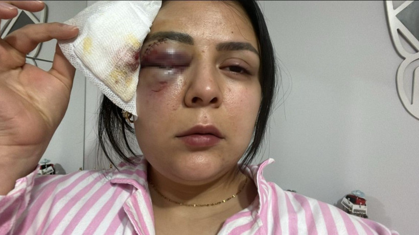 Kahramanmaraş'ta korkunç olay! Gözü dönmüş adam yoldan geçen kıza yumruk atıp gözünü morarttı!