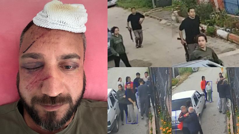 'İcraya verdiği eski sevgilisinin ailesi tarafından öldüresiye darp edildiğini' iddia etti: Görüntüler ortaya çıktı