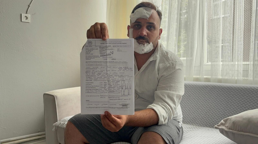 Taksiciden akıllara durgunluk veren iddia: Eski sözlüm ve ikizinin polis sevgilileri beni dövdü
