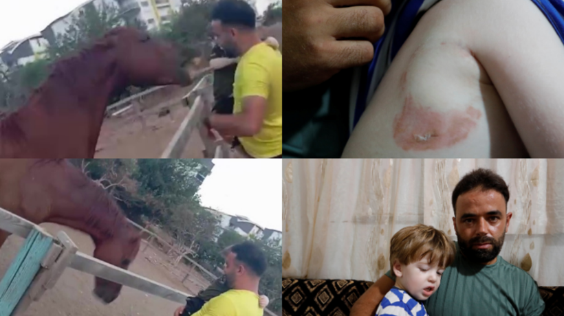 Attan beklenmedik hareket: Babasının kucağındaki çocuğu ısırarak alıp havaya fırlattı