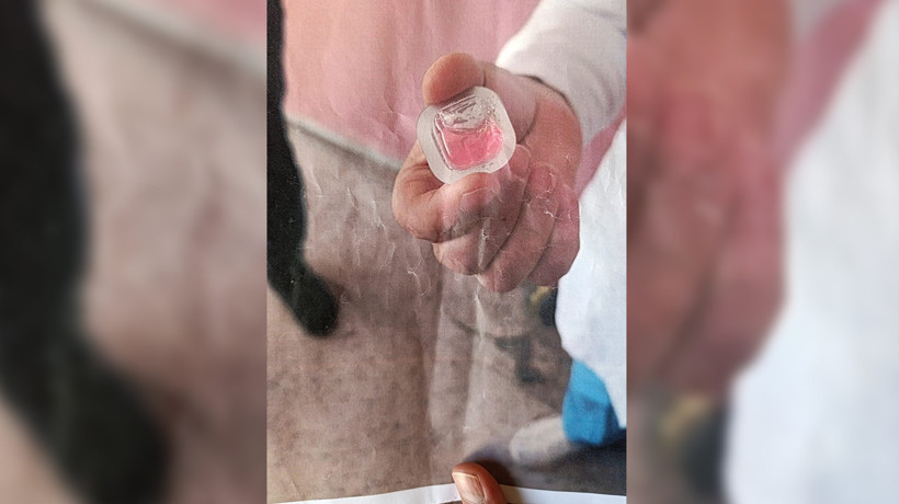 Havadan bırakılan kuduz aşısı paniğe neden oldu! Kapı kapı gezip fotoğraf göstererek tehlikeye dikkat çektiler