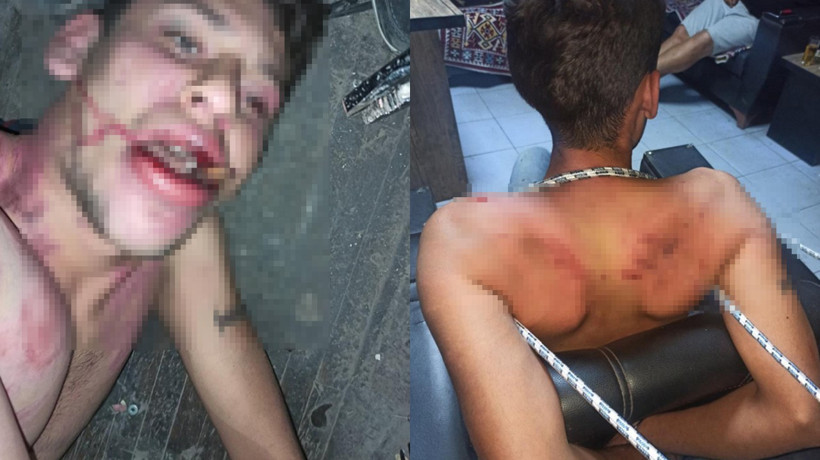 Böcek yedirip, dişlerini kırmışlardı! Savcının istediği ceza belli oldu