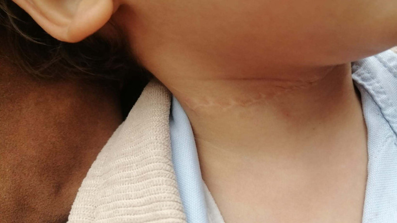 1,5 yaşındaki çocuğun boynunu kesen sanığa 21,5 yıl hapis