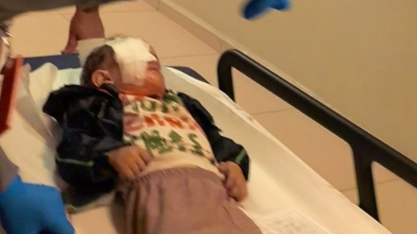 Bursa'da torpil faciasında 2 yaşındaki çocuk ağır yaralandı