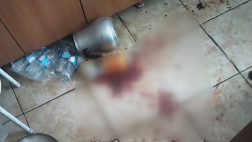 3 kardeşin miras davası kanlı bitti! Davalı yeğen, amcasının kafa derisini yüzdü - Resim: 3