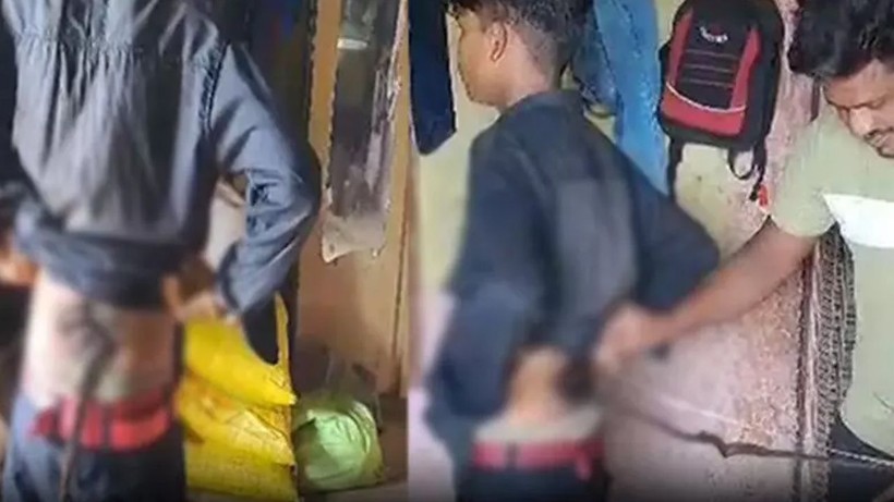 14 yaşında kuyruk kabusu yaşıyor! Babası kesmeye çalıştı - Resim: 1