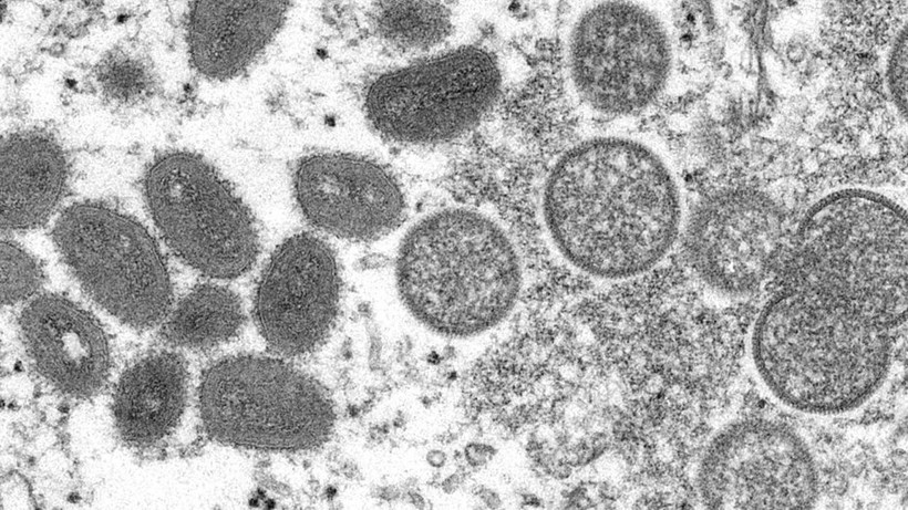 Kovid-19 belası geri mi geliyor? DSÖ'den korkutan açıklama: Daha tehlikeli varyantın ortaya çıkma riski devam ediyor - Resim: 5