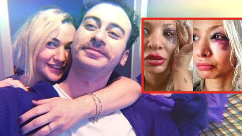 Yüzyüzeyken Konuşuruz'un gitaristi Can Tunaboylu ile ilgili skandal! "Tunaboylu, sevgilisi Aybike Çelik'i eve hapsedip darp etti" - Resim: 1
