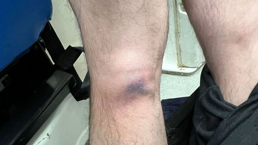 Sağlık çalışanlarına dehşeti yaşattılar! Baba oğul demir sopalarla saldırdı - Resim: 3