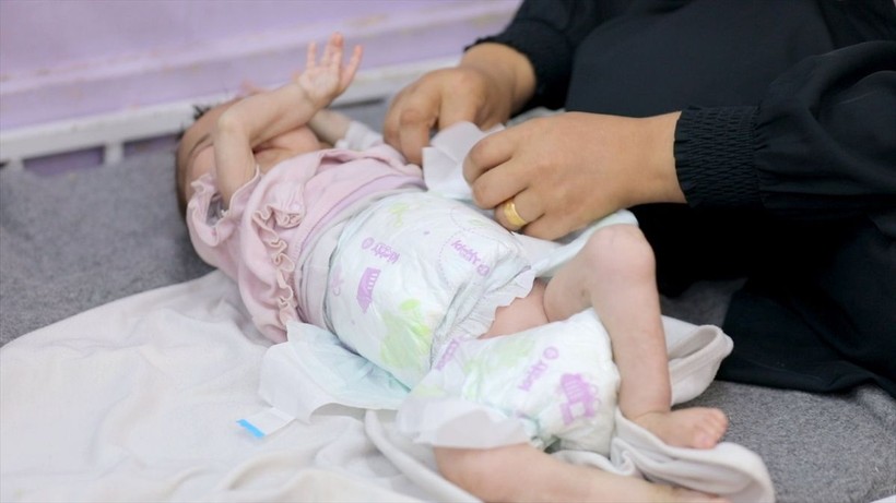 Gazze'de çocuklar açlık nedeniyle ölümle boğuşuyor - Resim: 9