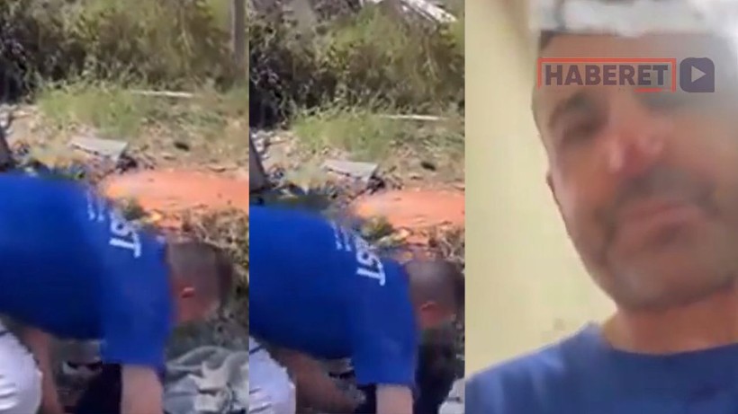 Yaralı köpeği beslerken saldırısına uğradı! Doktorun sözlerine rağmen tek derdi bakın ne oldu - Resim: 1