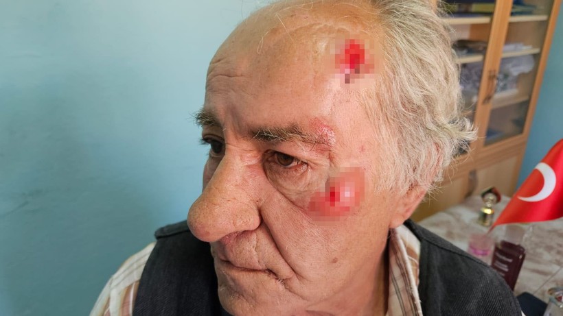 Köpeklerin saldırısına uğrayan yaşlı adam canını zor kurtardı - Resim: 5