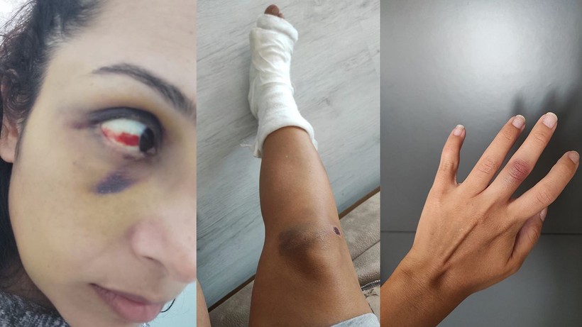 Burcu öğretmenin yardım feryadı: Kurtarın beni - Resim: 1
