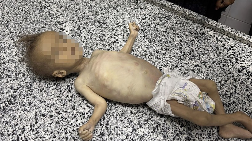 Gazze'de Selam Ebu Vadi açlıktan öldü - Resim: 23