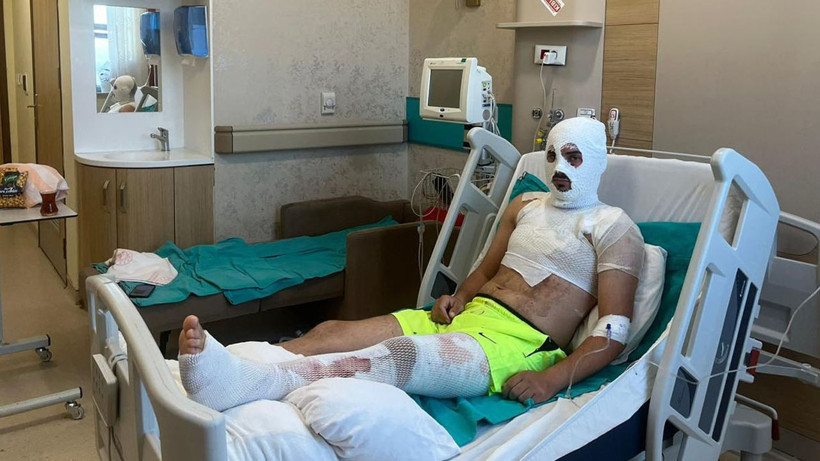 Bayburt’ta elektrik akımına kapılan 22 yaşındaki genç ölümden döndü, vücudunda 3'üncü derece yanıklar oluşan gencin ailesi isyan etti - Resim: 1