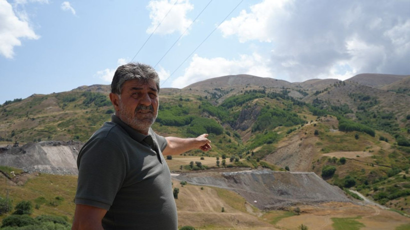 Bayburt’ta elektrik akımına kapılan 22 yaşındaki genç ölümden döndü, vücudunda 3'üncü derece yanıklar oluşan gencin ailesi isyan etti - Resim: 3