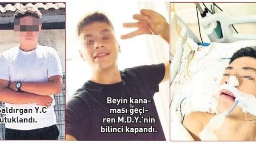 Çanakkale’de okulda akran dehşeti: 14 yaşındaki çocuk beyin kanaması geçirdi, yoğun bakımda - Resim : 2