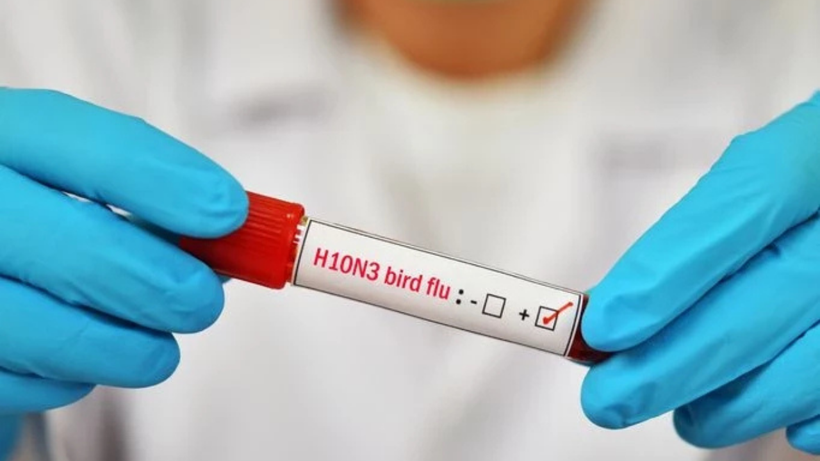 H5N5 paniği: Dünyada ilk kez can aldı! - Resim: 2