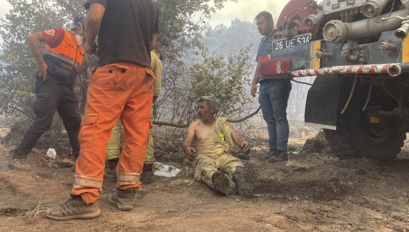 Eskişehir'de çıkan orman yangının yaralanan işçi: Yanıyorum - Resim: 1