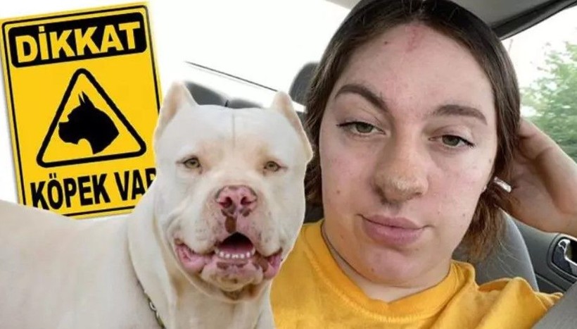 Ameliyattan sonra hayatı değişti! Burnundan saç çıkan kadını gören dönüp bir daha bakıyor! - Resim: 3