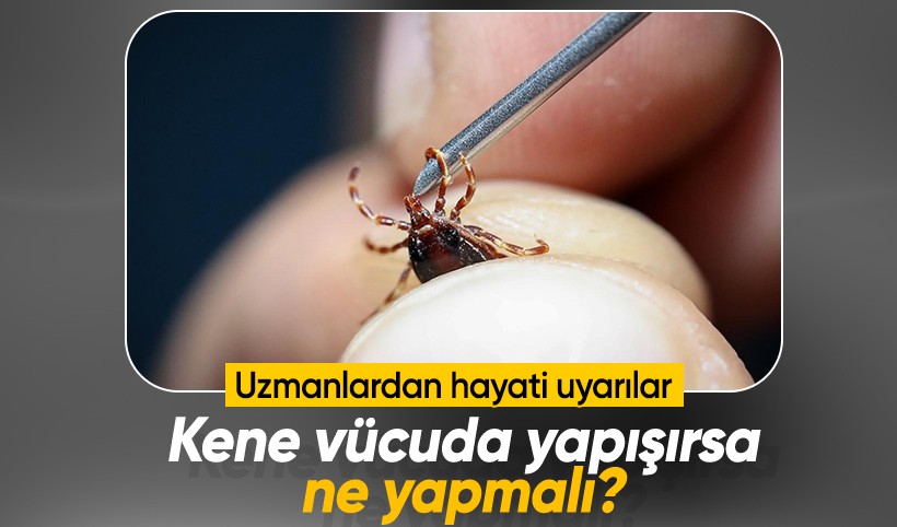 Sakın dokunmayın! Kene vücuda yapışırsa ne yapmalı, nasıl çıkarılmalı?