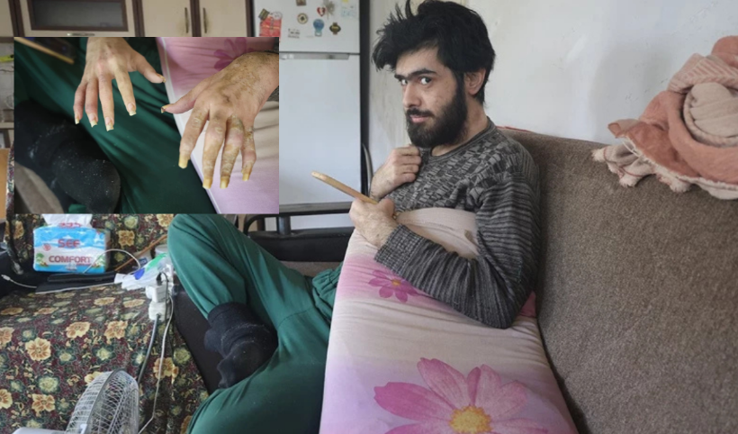 Akıllara durgunluk veren olay! 3 yıldır ne duş alıyor ne evden çıkıyor