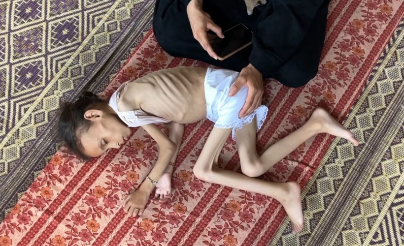 Gazze'de açlıkla mücadele: 9 yaşındaki Meryem 10 kiloya düştü
