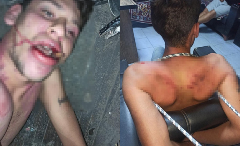 Böcek yedirip, dişlerini kırmışlardı! Savcının istediği ceza belli oldu