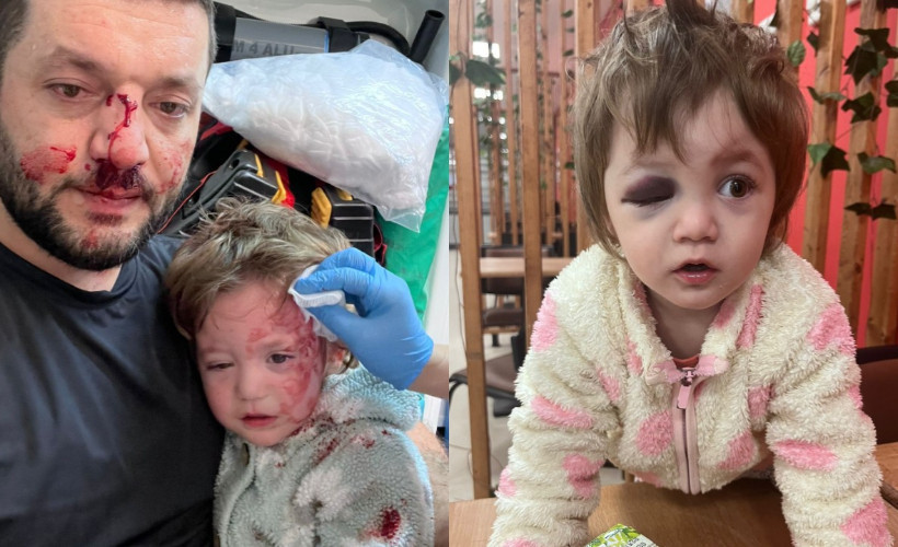 14 aylık bebek ile babasına komşu saldırısı: Serbest kalan abi olanları bambaşka anlattı