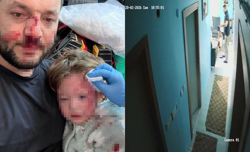 Yalova'da 14 aylık bebeğin yaralandığı komşu kavgası güvenlik kamerasına yansıdı