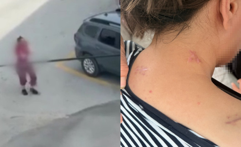 17 bıçak darbesi alıp ölü numarasıyla kurtuldu: Talihsiz kadının tek bir isteği var