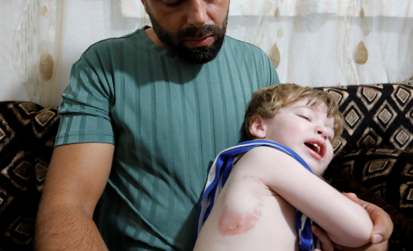 Attan beklenmedik hareket: Babasının kucağındaki çocuğu ısırarak alıp havaya fırlattı - Resim : 2