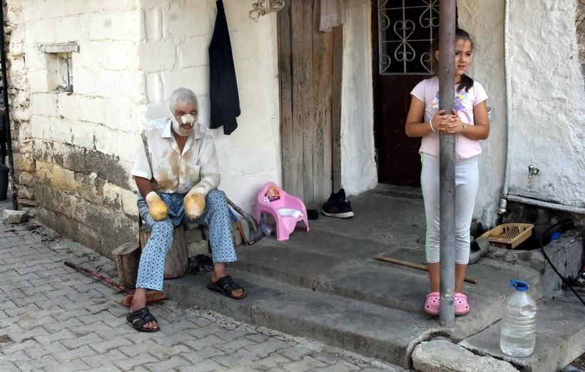 Çanakkale'de alevlerin arasında kaldı ölümden döndü! Dehşet anları anlattı: Yukarıdan ateş yağıyordu - Resim: 4