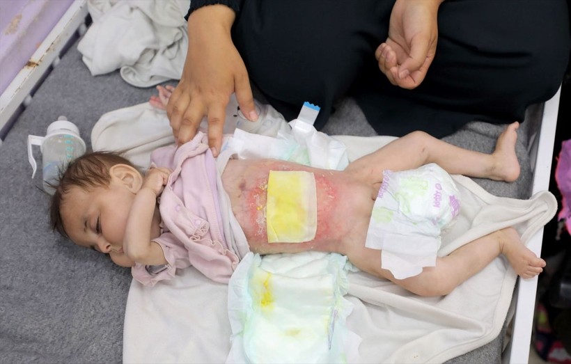 Gazze'de çocuklar açlık nedeniyle ölümle boğuşuyor - Resim: 12